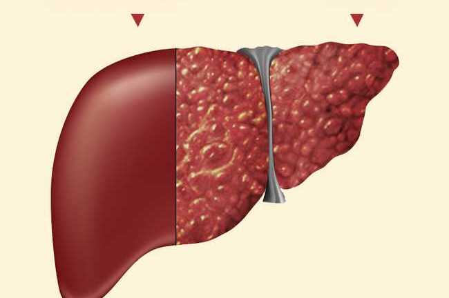 Hàng loạt virus gây bệnh viêm gan, hầu hết chúng ta không biết