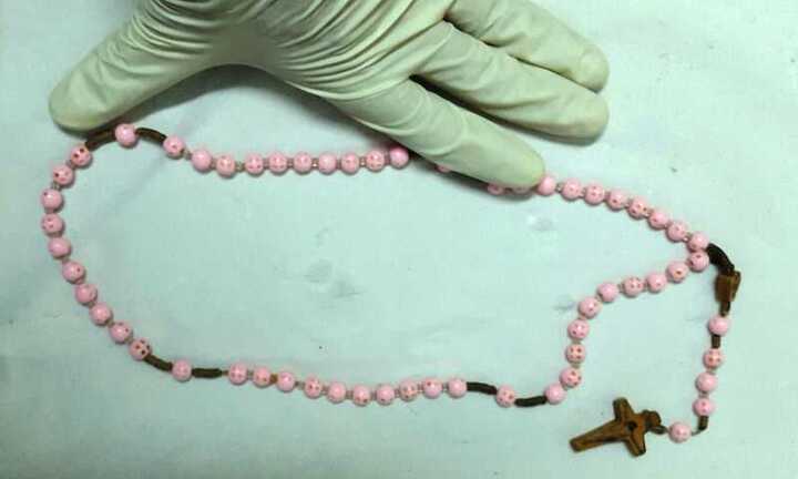 Hoảng hốt vì chuỗi hạt 80 cm nằm trong thực quản cụ bà