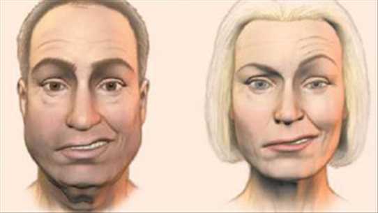 Cách đơn giản chữa méo miệng do trúng gió độc