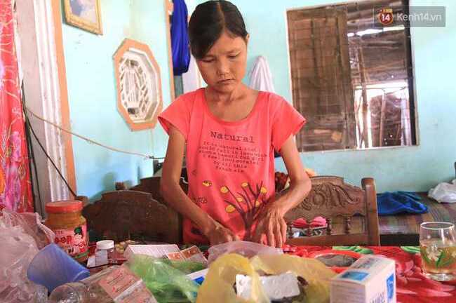 Căn bệnh lạ khiến cô gái trẻ bị lão hóa, ăn không biết no, uống không hết khát