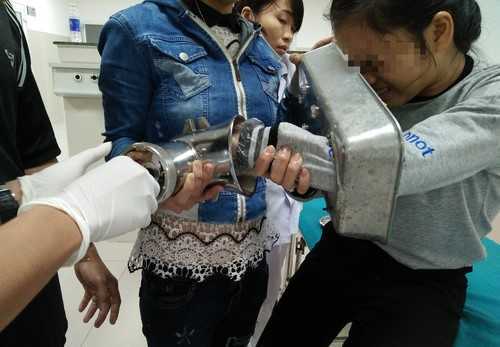 Cấp cứu bé gái 15 tuổi bàn tay bị cuốn vào máy xay thịt