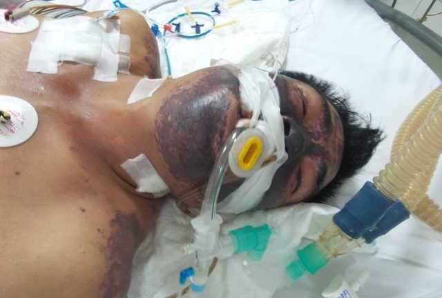 Căn bệnh chết người dễ mắc phải vì những hiểu lầm này