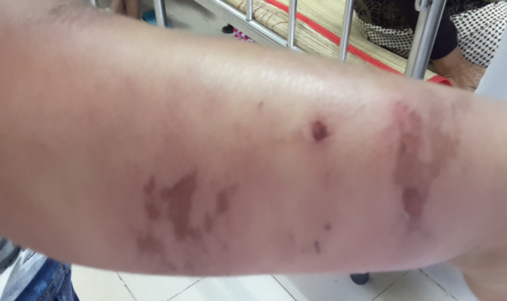 Suýt chết vì trị bệnh bằng bùa khoán