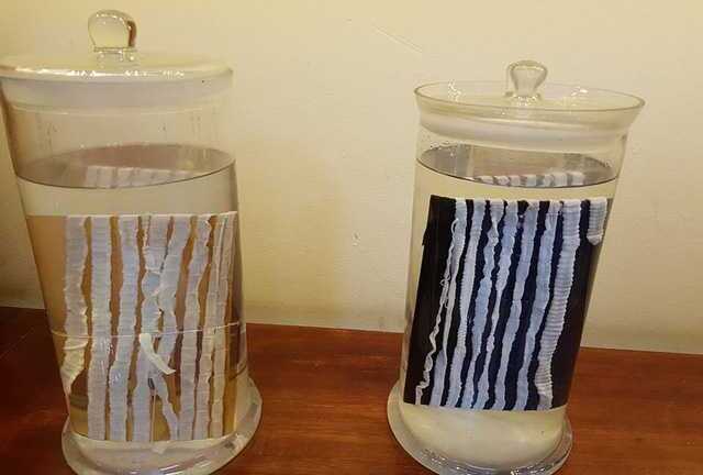 Hãi hùng hình ảnh ký sinh trùng 'đục gan', bó giun gây tắc ruột