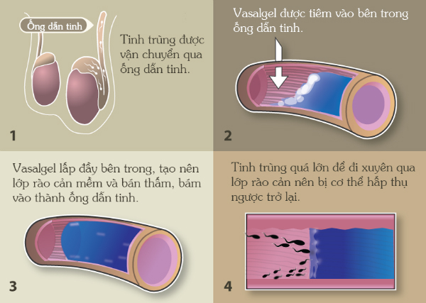 Phát minh kỳ diệu: Loại thuốc giúp đàn ông tránh thai trong 2 năm