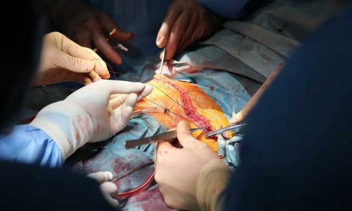 Chuyện chưa kể về ca ghép phổi đầu tiên ở Việt Nam kéo dài 10 tiếng