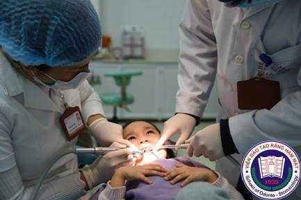 Vì sao không nên tự nhổ răng sữa cho bé?