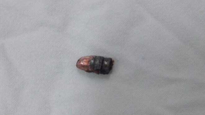 Đi bắt cá, nhặt được 'vật thể lạ' phát nổ, nam thanh niên nhập viện cấp cứu