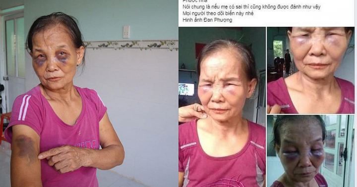 Thực hư chuyện con dâu đánh mẹ chồng bầm tím mặt mũi đang lan truyền trên mạng xã hội