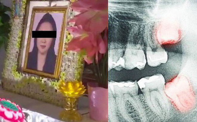 Video: Vừa chiến thắng ung thư, người phụ nữ lại mất mạng vì răng khôn