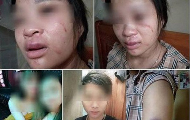 Video: Chỉ vì mua đôi giày, thai phụ bị chồng đánh động thai