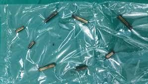 Nuốt 8 thanh nam châm vào bụng, bé trai 4 tuổi bị thủng ruột