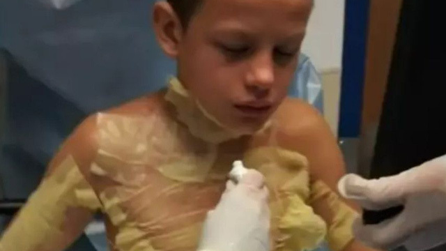 Video: Học theo trào lưu trên Youtube, cậu bé suýt bị thiêu cháy