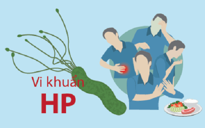 Video: 80% dân số Việt Nam nhiễm vi khuẩn HP trong đường tiêu hóa