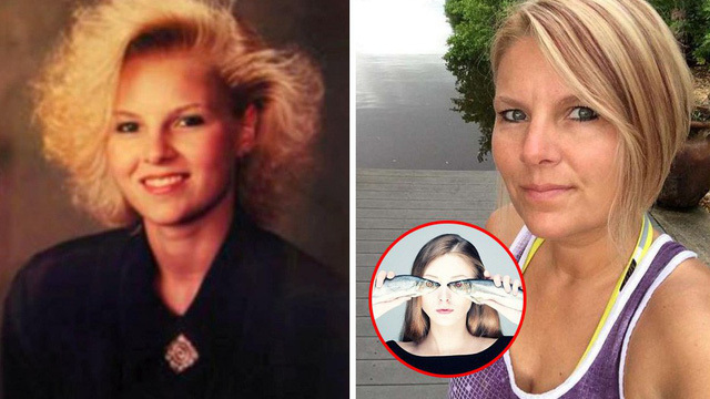 Video: Mắc bệnh hiếm gặp, cơ thể người phụ nữ có mùi cá ươn