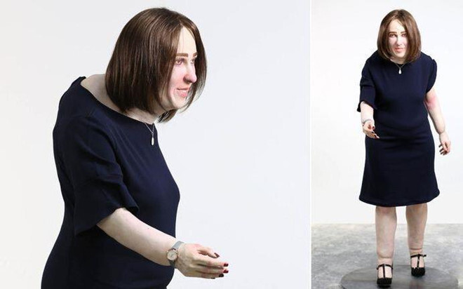 Dân văn phòng 20 năm nữa lưng gù, chân sưng, mắc nhiều bệnh nguy hiểm