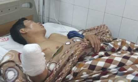 130 ca cấp cứu do pháo nổ trong 4 ngày nghỉ Tết