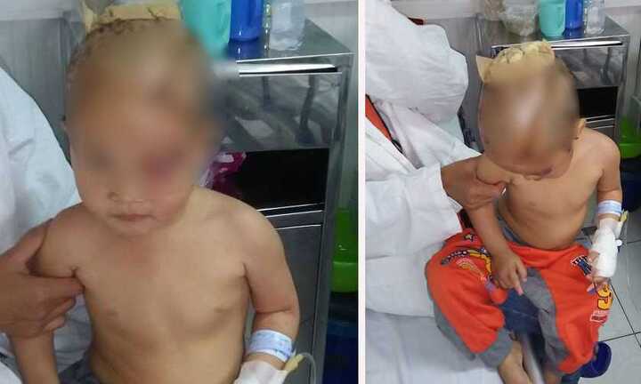 Thương tâm bé 3 tuổi bị chó hoang cắn xé, lôi đi