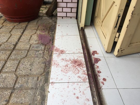 Nhà bác sĩ liên tục bị 'khủng bố' bằng mắm tôm sau khi nhắc nhở hàng xóm