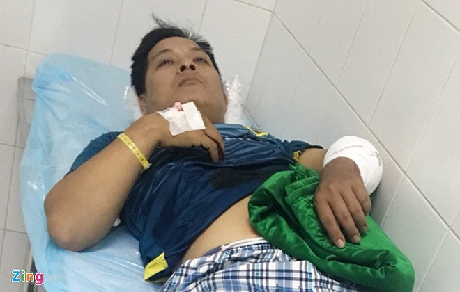 Tài xế bị chém đứt gân tay vì chuyện cẩu xe tại BOT Cai Lậy