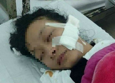 Khởi tố vụ nữ sinh lớp 11 bị rạch mặt giữa chợ ở Thanh Hóa
