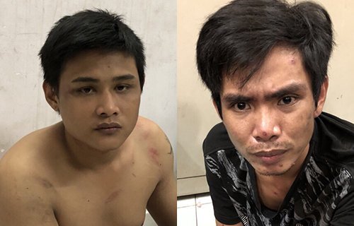 Bị vây bắt, tên cướp cắn chảy máu cảnh sát đặc nhiệm TP.HCM