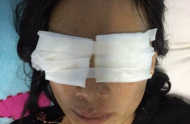 Phát hiện thi thể mẹ chồng tạt axit con dâu bỏng 2 mắt tại nhà riêng