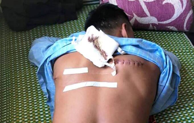 Đi ăn đêm, nam thanh niên bị đánh chém rồi cướp tài sản