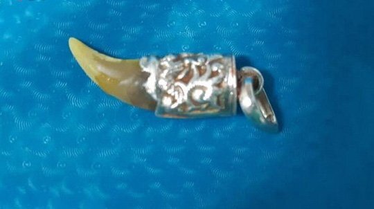 Nuốt phải nanh hổ bọc bạc dài 2cm, bé trai nhập viện