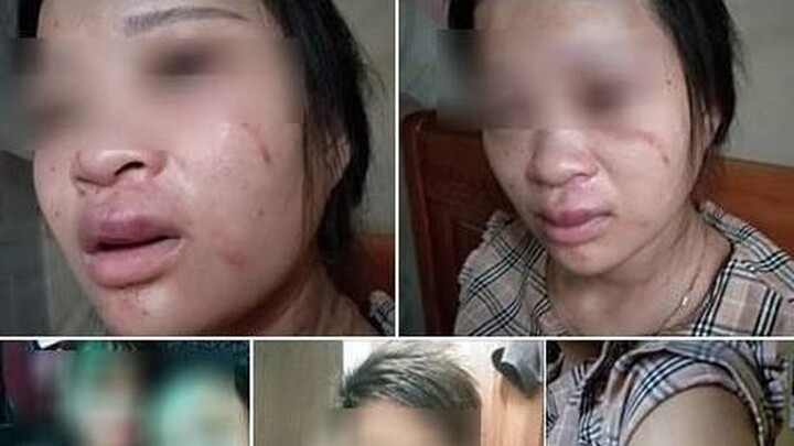 Mua đôi giày 135.000 đồng trên mạng, vợ mang thai sắp sinh bị chồng đánh tới tấp