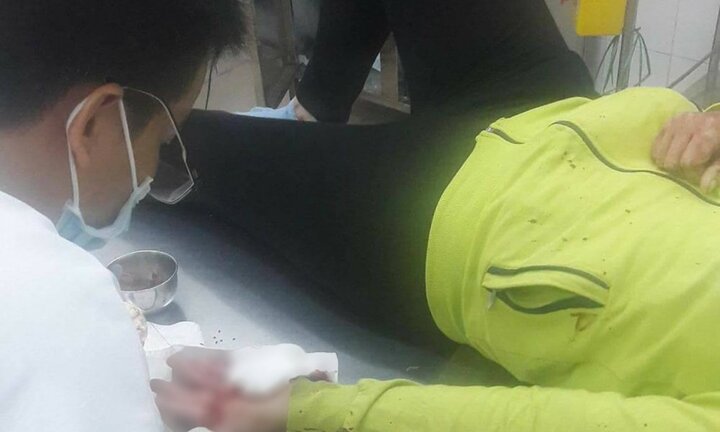 Chém xối xả lên người phụ nữ để cướp xe ở Đồng Nai