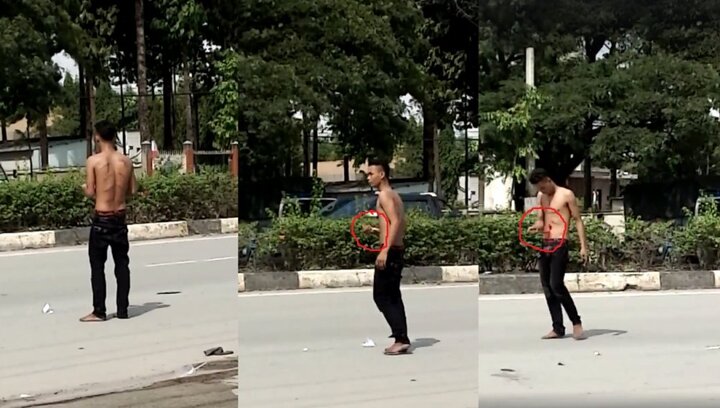 Nam thanh niên dùng dao tự đâm thủng bụng rồi đứng la hét giữa phố