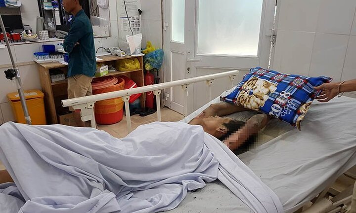 Nam thanh niên ngáo đá nhốt người yêu rồi đốt phòng trọ