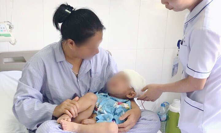 Bác sĩ khoan sọ não, cứu bé trai tụ máu khắp đầu vỡ xương sọ