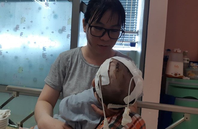 11 lần lên bàn mổ, chưa một lần được về nhà, bé trai 14 tháng tuổi thoi thóp tìm sự sống