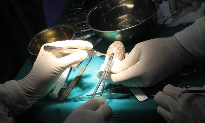 Sinh ra không có âm đạo, một phụ nữ phải chịu đau khổ suốt 23 năm trời