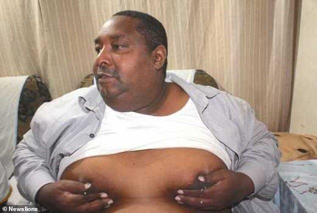 Mắc bệnh lạ, ngực người đàn ông liên tục chảy 'sữa' như gái đẻ