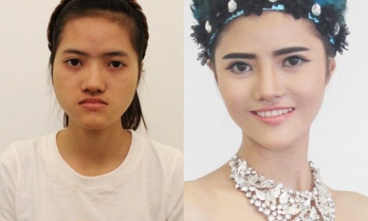 Cô gái trẻ 'đập mặt làm lại' mong thành DJ xinh đẹp