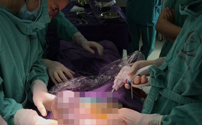 Đột nhiên đau bụng, đi khám mới biết bị ung thư buồng trứng