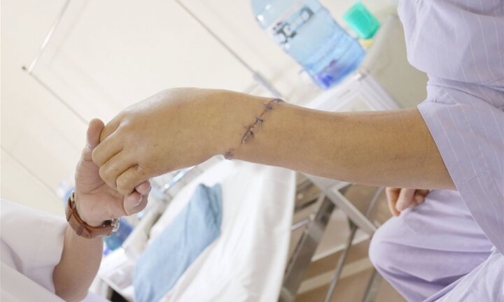 Xe goòng chèn nát cánh tay người đàn ông