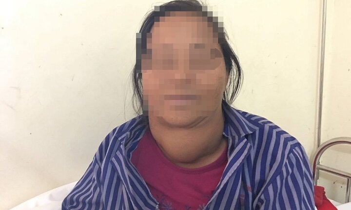 Người phụ nữ ‘đeo’ khối bướu nặng 1,5kg trên cổ suốt 20 năm