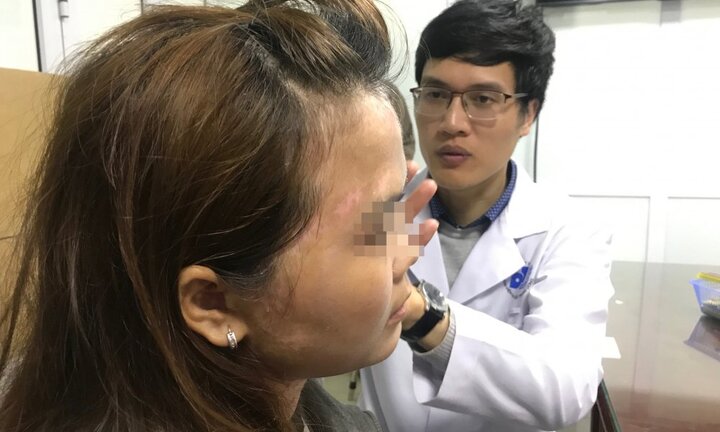 Chuyên gia bóc mẽ mẹo đắp lá trầu không trị nám nhanh