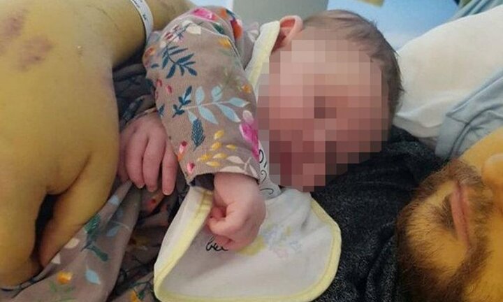 ‘Nốc’ 1 lít rượu, 20 lon bia mỗi ngày, thanh niên 26 tuổi suy gan nguy kịch