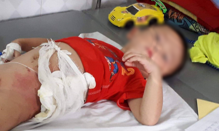 Giành ăn quả dưa chuột, cậu ruột ném cháu trai 4 tuổi vào đống lửa