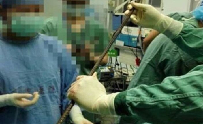 Cứu sống người đàn ông bị thanh sắt đâm xuyên từ háng lên đầu