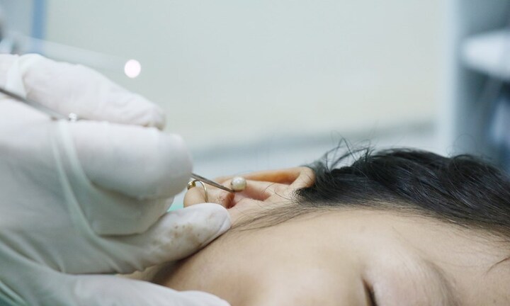 Hạt đồ chơi 'đi lạc' vào tai bé gái 8 tuổi ở Quảng Ninh