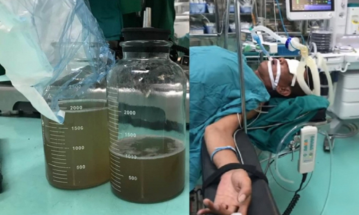 Hy hữu: Hút dầu chạy máy bằng miệng, người đàn ông sặc suýt chết