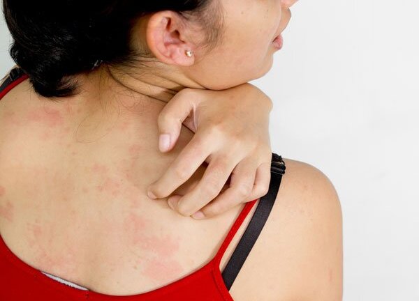 Những dấu hiệu tố cáo thận của bạn đang gặp vấn đề