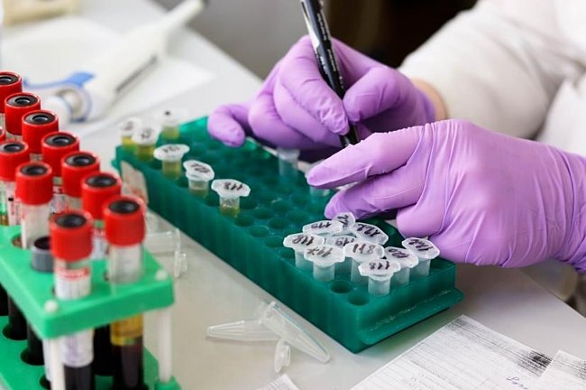 Xét nghiệm máu có thể dự báo trước cái chết