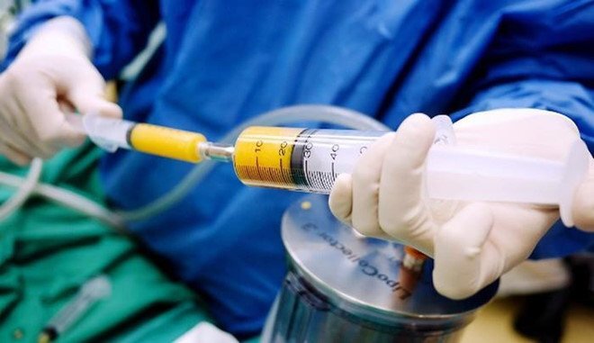 Thực hư phương pháp làm đẹp ‘hút mỡ chỗ thừa, đắp vào chỗ thiếu’